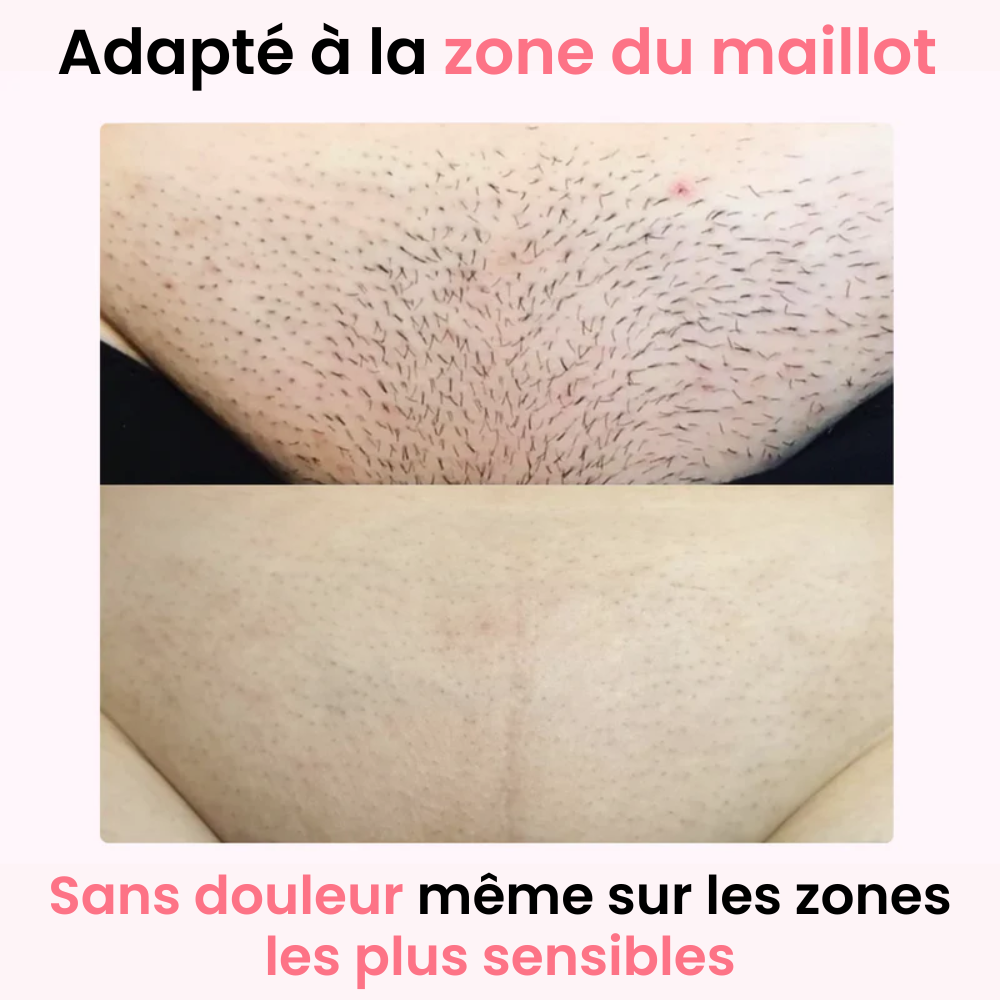 Depiladora de Luz Pulsada Profesional (IPL) - Ulvessa Lite