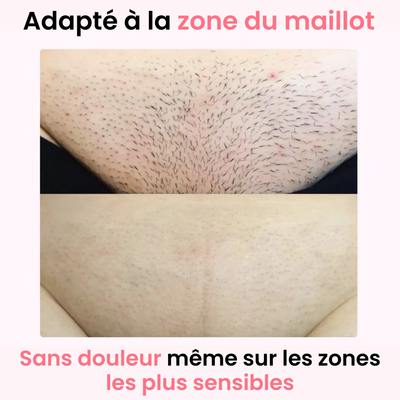 Depiladora de Luz Pulsada Profesional (IPL) - Ulvessa