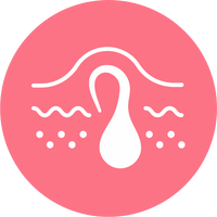 No más pelos encarnados