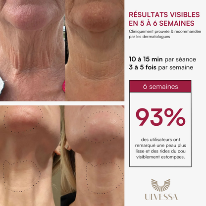 Máscara LED facial profesional - ULVESSA Serie 2