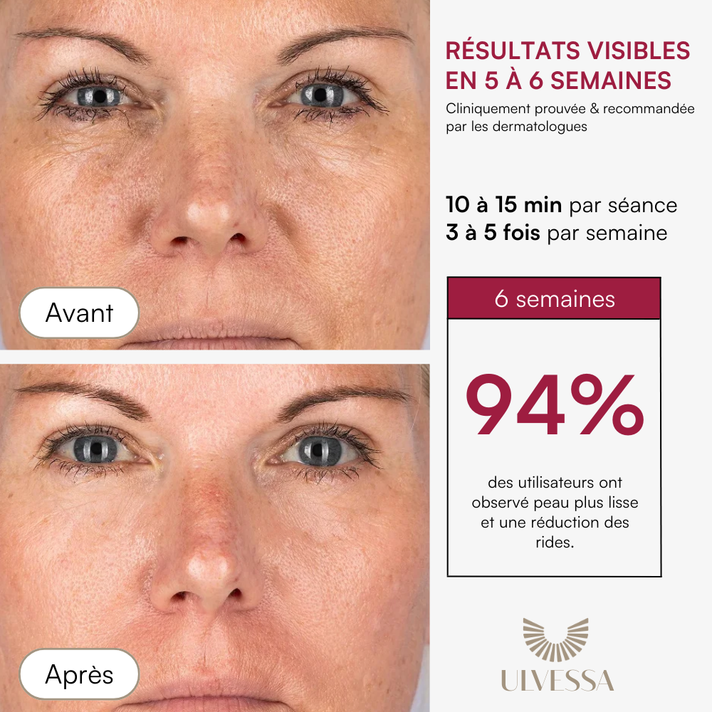 Máscara LED facial profesional - ULVESSA Serie 2